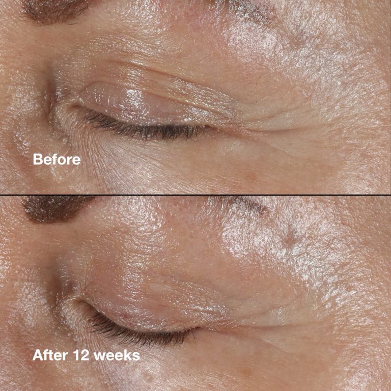 کرم دور چشم اسمارت کلینیک - تصویر 8