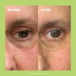 Niacinamide & Caffeine Eye Bright Cream کرم دور چشم حاوی کافئین و نیاسینامید کوپاری