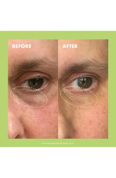 Niacinamide & Caffeine Eye Bright Cream کرم دور چشم حاوی کافئین و نیاسینامید کوپاری