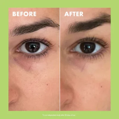 Niacinamide & Caffeine Eye Bright Cream کرم دور چشم حاوی کافئین و نیاسینامید کوپاری