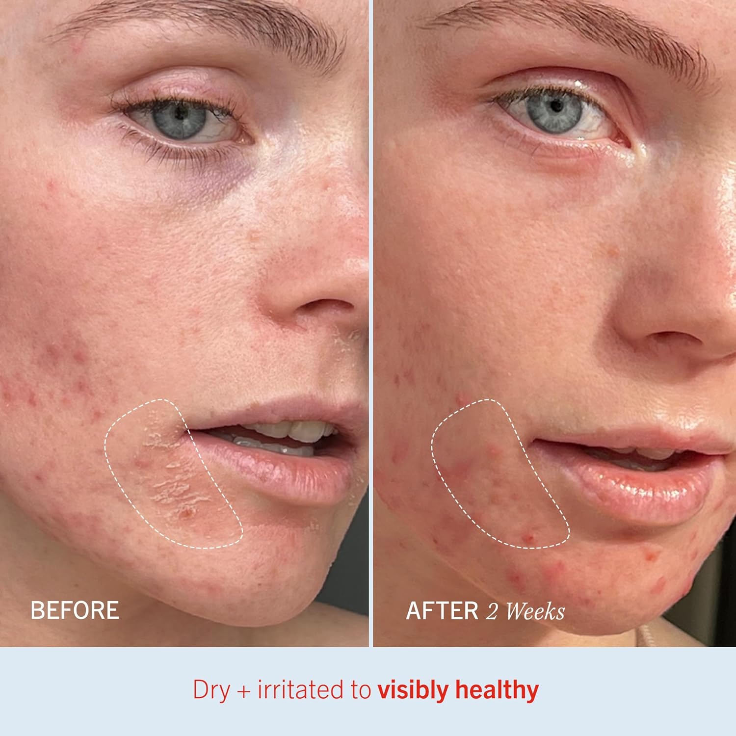 پد روشنکننده و لایهبردار فرست اید بیوتی - تصویر 8