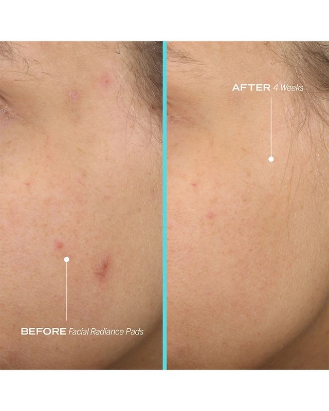 پد روشنکننده و لایهبردار فرست اید بیوتی - تصویر 6