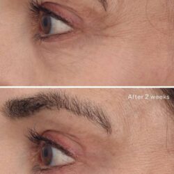 IMG_3561 سرم رتینول جوانساز دور چشم موراد