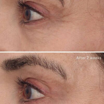IMG_3561 سرم رتینول جوانساز دور چشم موراد